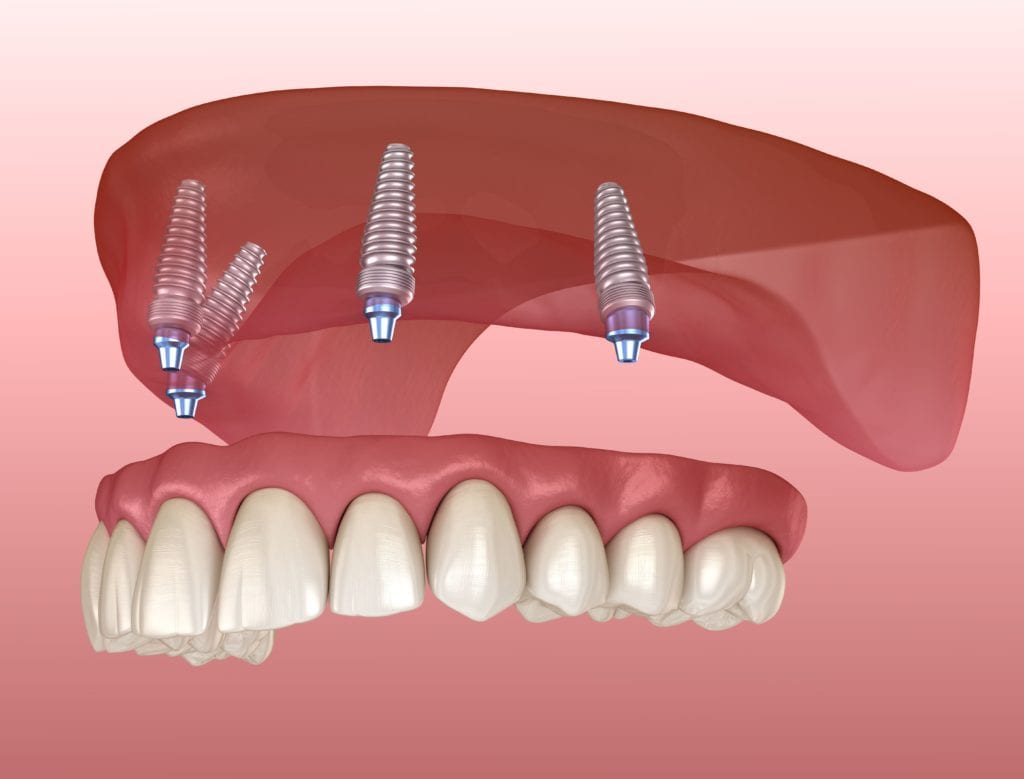 How Dentists Can Use Social Media to Engage with Patients 